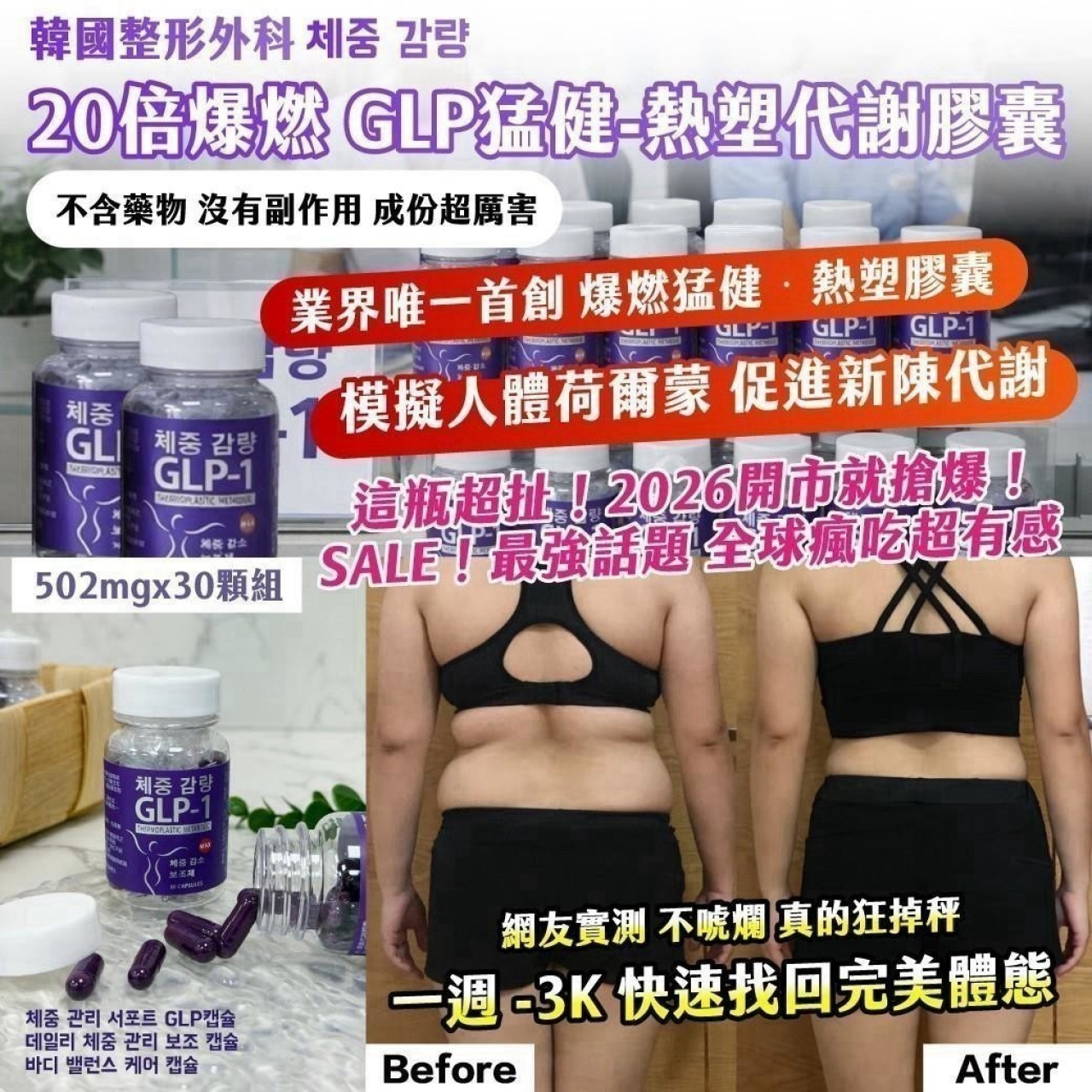 韓國整形外科 체중 감량 20倍爆燃 GLP猛健 熱塑代謝膠囊